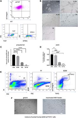 Impact of the hypoxic microenvironment on spermatogonial stem cells in culture